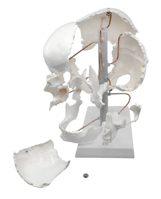 Beauchene Exploded Skull Model - 13 Parts - Life Size - Mounted on Stand