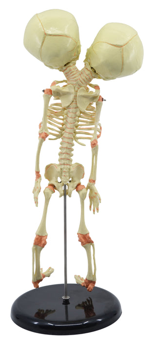 Infant Fetus Skeleton Model, Mini Size - Twin, Conjoined Skull - Rod Mounted