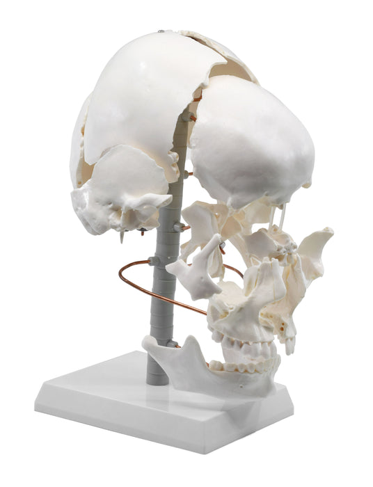 Beauchene Exploded Skull Model - 13 Parts - Life Size - Mounted on Stand