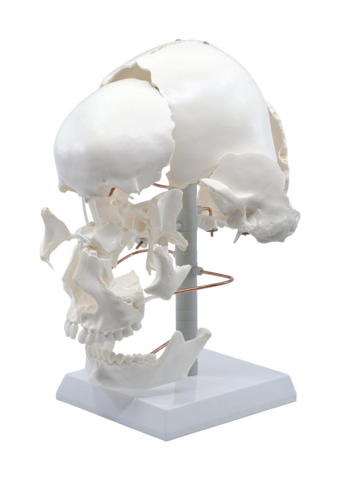 Beauchene Exploded Skull Model - 13 Parts - Life Size - Mounted on Stand