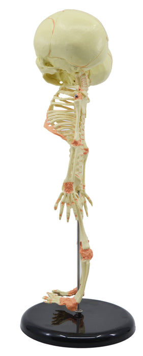 Infant Fetus Skeleton Model, Mini Size - Twin, Conjoined Skull - Rod Mounted
