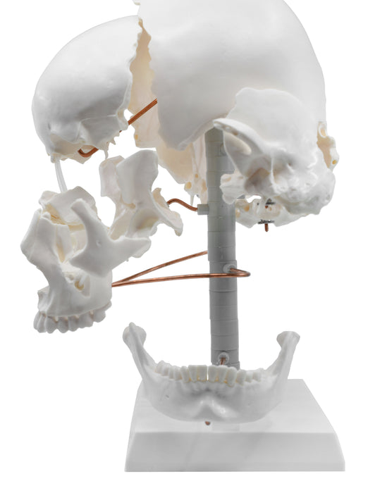 Beauchene Exploded Skull Model - 13 Parts - Life Size - Mounted on Stand