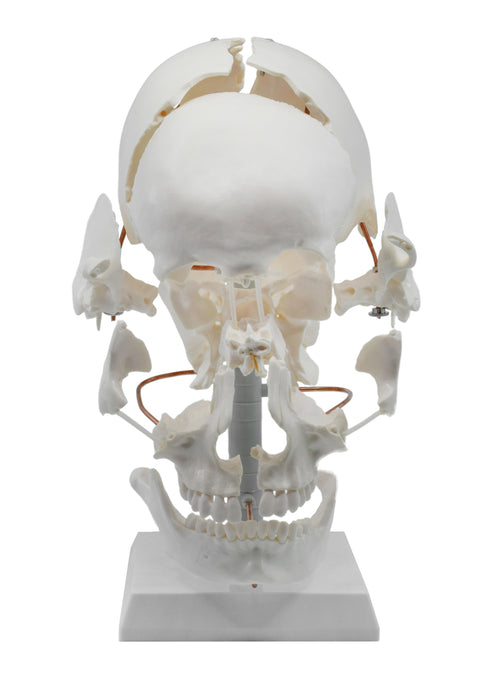 Beauchene Exploded Skull Model - 13 Parts - Life Size - Mounted on Stand