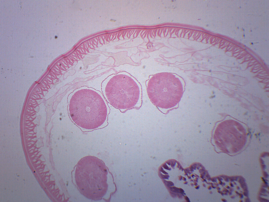 Ascaris lumbricoides - Prepared Microscope Slide