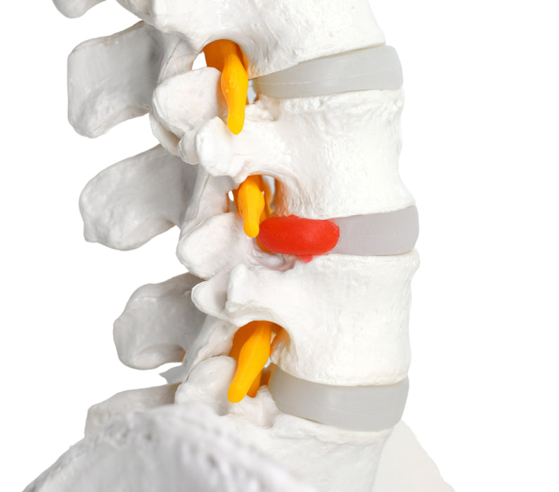 Human Spine Model, Flexible - 31.5" Height - Includes Mount