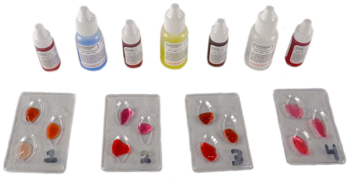 Simulated ABO/Rh Blood Typing Kit - Safe & Easy - Mat'l for 10 Setups ...
