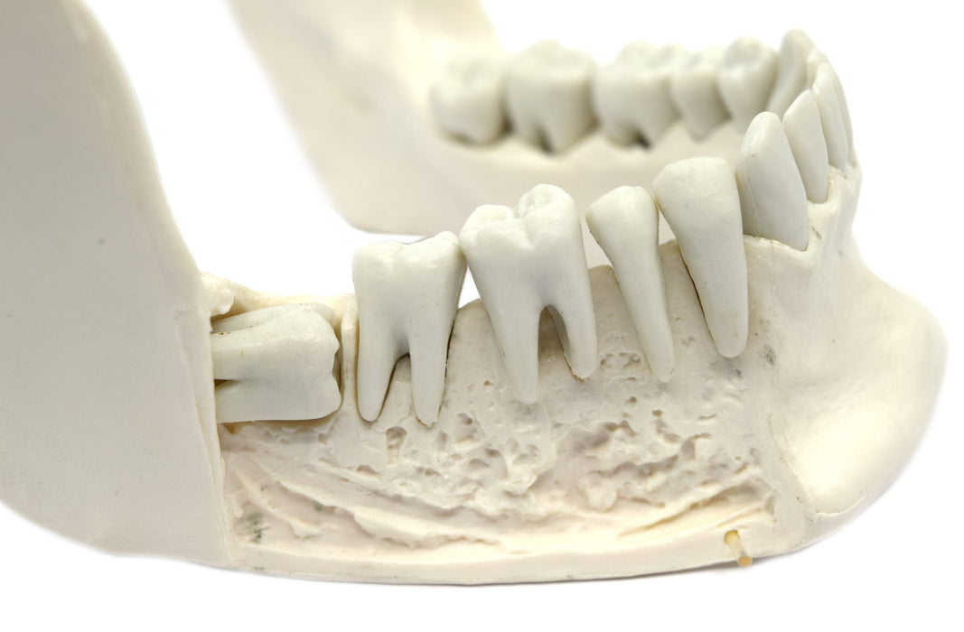 Lower Jaw Bone Model - 16 Extractable Teeth, Removable Jaw Section