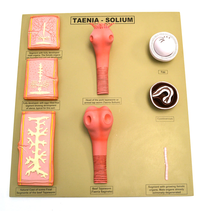 Tapeworm/Taenia-Solium Model, 20 Inch - Features 8 Stages