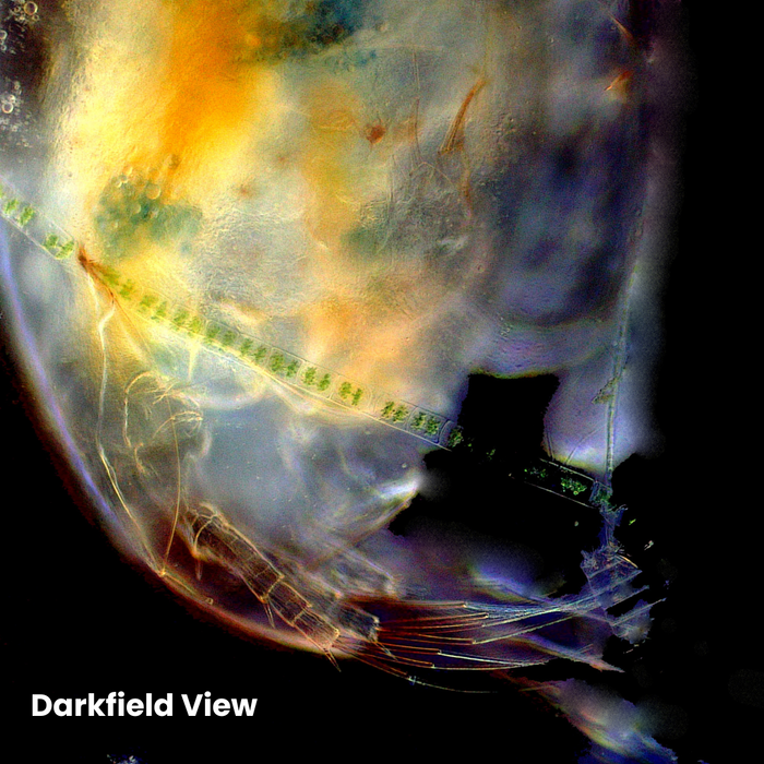 Accu-Scope EXM-150-MS-DF 2-in-1 Brightfield/Darkfield Microscope - Monocular, 40-400X Magnification, Mechanical Stage, Cordless LED, Student-Proof Design for Laboratory & Home - Biological Microscope