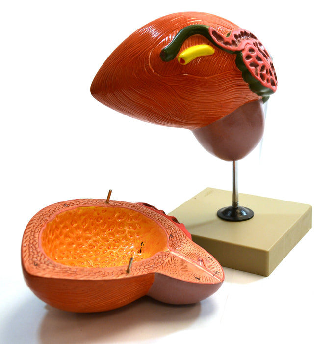 Eisco Labs Human Urinary Bladder with Prostate Anatomical Model, 2 Parts, 3 Times Life Size, Approx. 8"x8"x6"