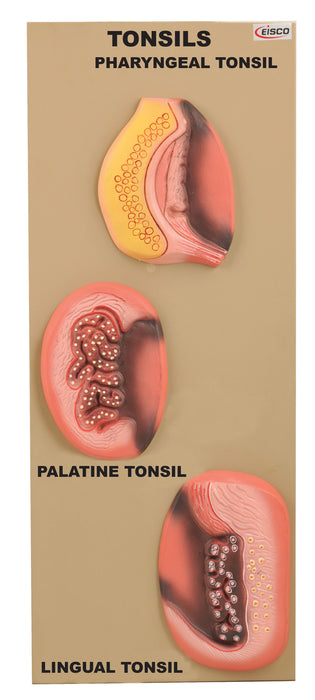 Model Tonsils