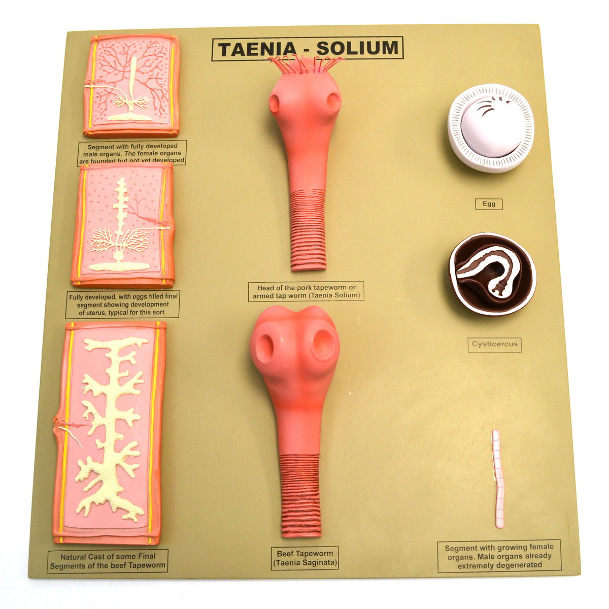Tapeworm/Taenia-Solium Model, 20 Inch - Features 8 Stages — hBARSCI