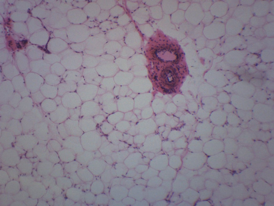 Adipose Tissue Section, Mammal - Prepared Microscope Slide