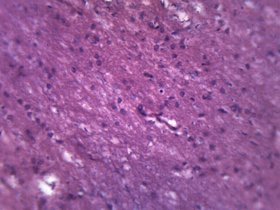 Brain Section - Prepared Microscope Slide - 75x25mm