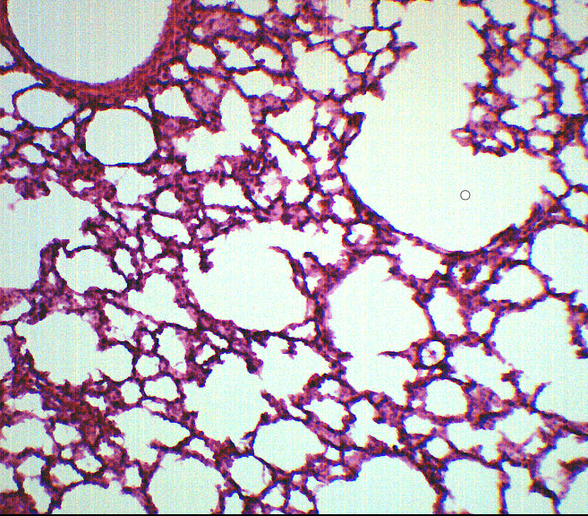 Lung Section - Prepared Microscope Slide