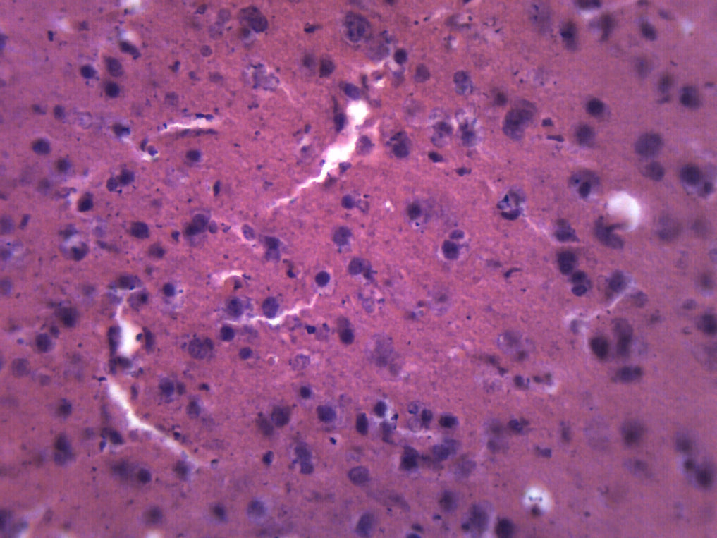 Brain Section - Prepared Microscope Slide - 75x25mm — hBARSCI