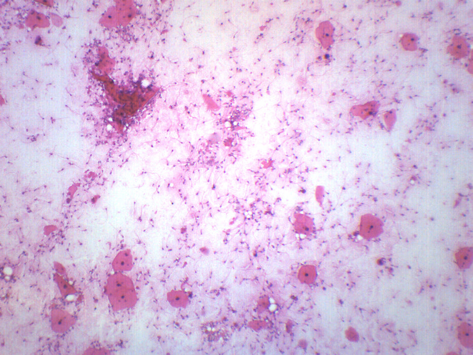 Human Sperm Smear - Prepared Microscope Slide