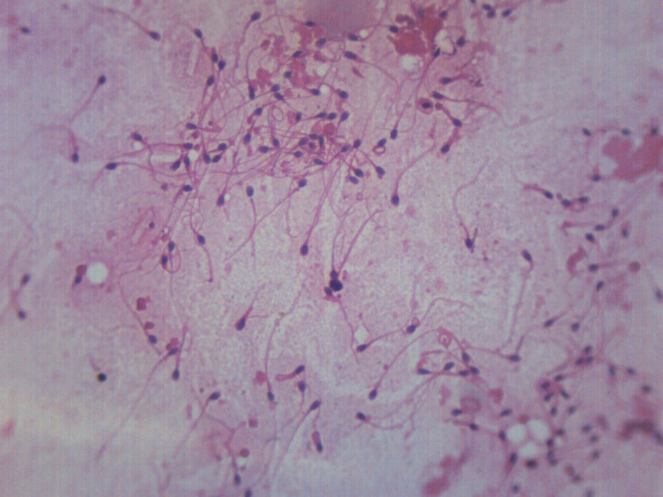Human Sperm Smear - Prepared Microscope Slide