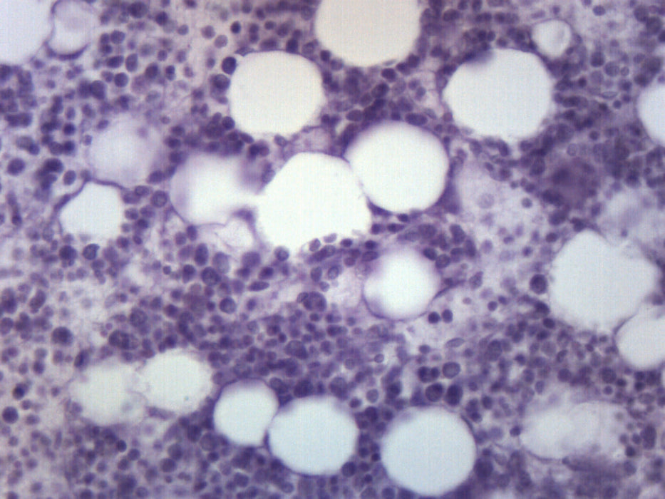 Red Bone Marrow Section - Prepared Microscope Slide - 75x25mm