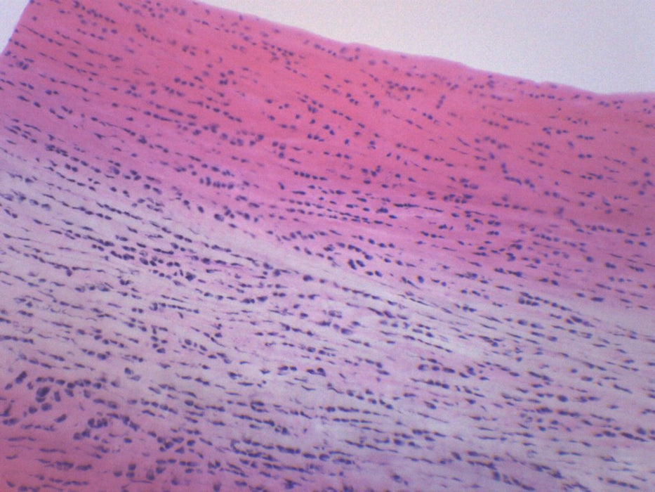 White Fibrocartilage, Mammal - Prepared Microscope Slide