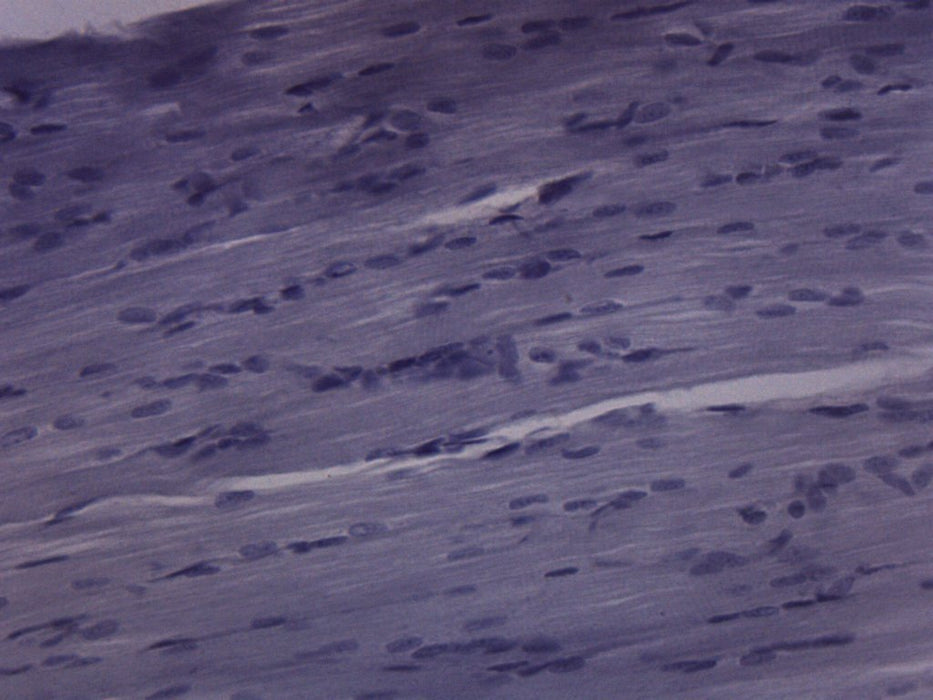 Frog Striated Skeletal Muscle - Prepared Microscope Slide - 75x25mm