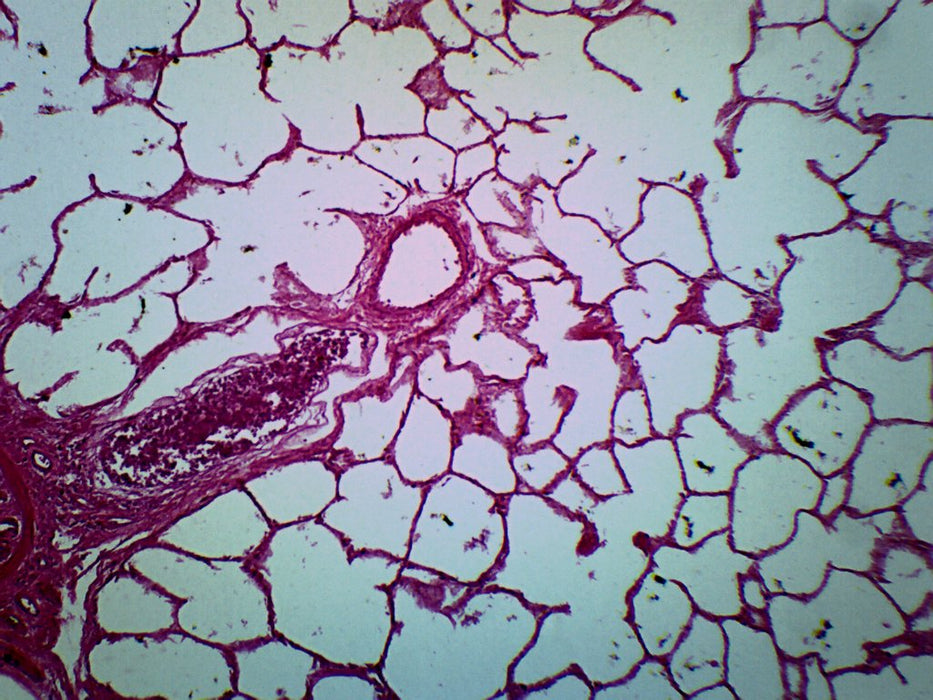 Lung Of Cat - Prepared Microscope Slide - 75x25mm