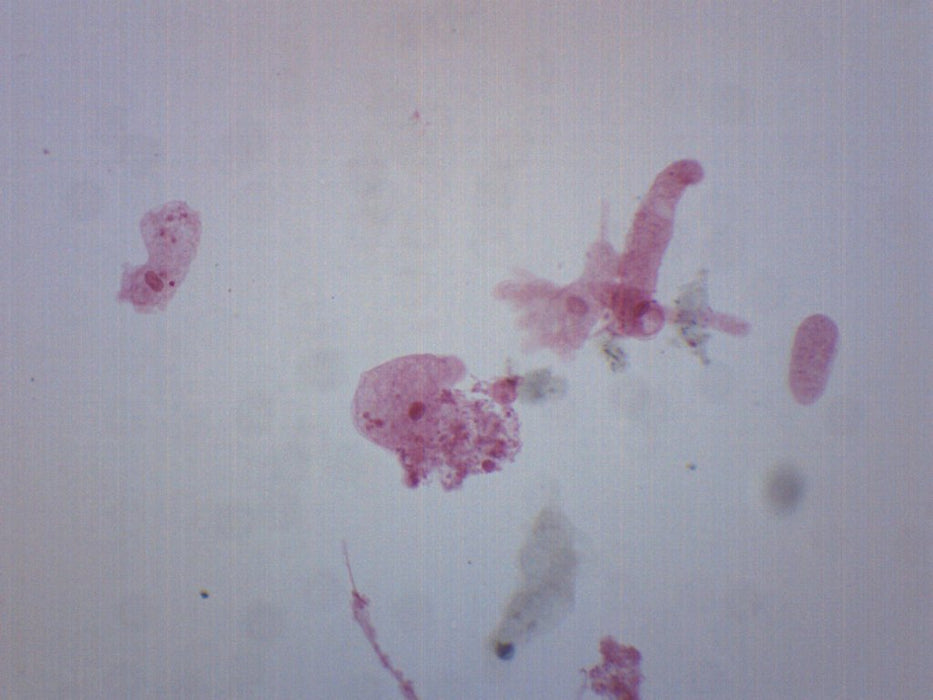 Amoeba proteus, Whole Mount - Prepared Microscope Slide