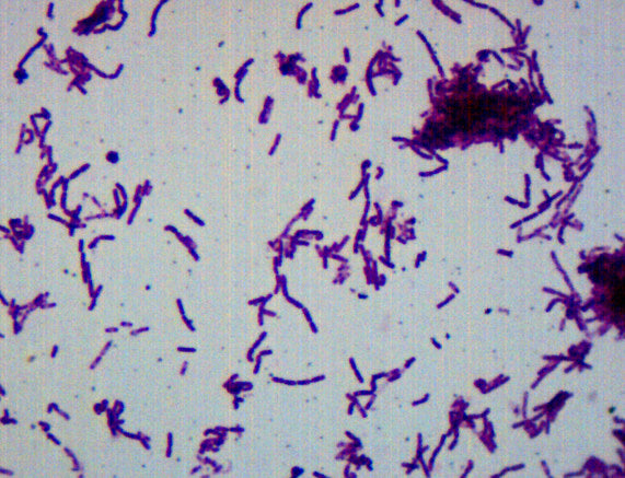 Bacillus Smear, Gram-Negative - Prepared Microscope Slide