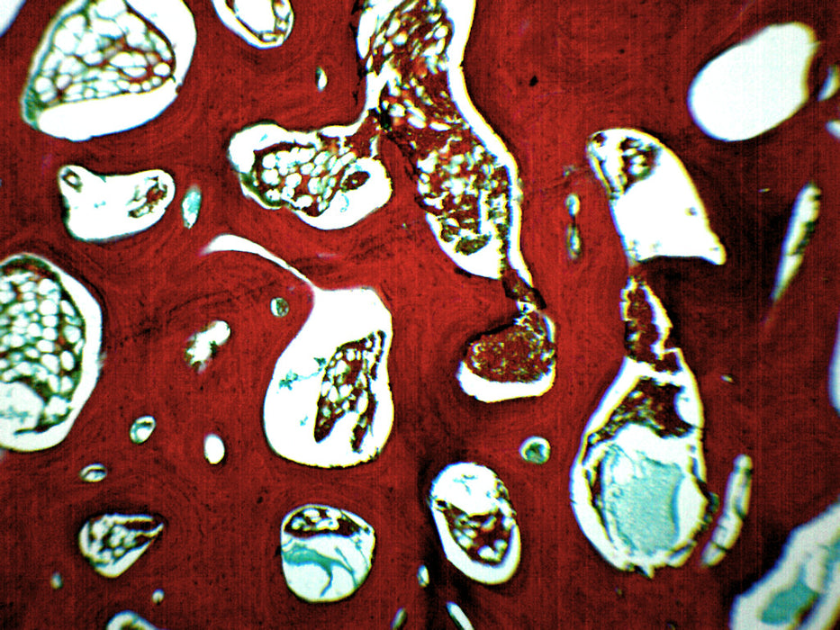 Spongy Bone Section (Mammal) - Prepared Microscope Slide