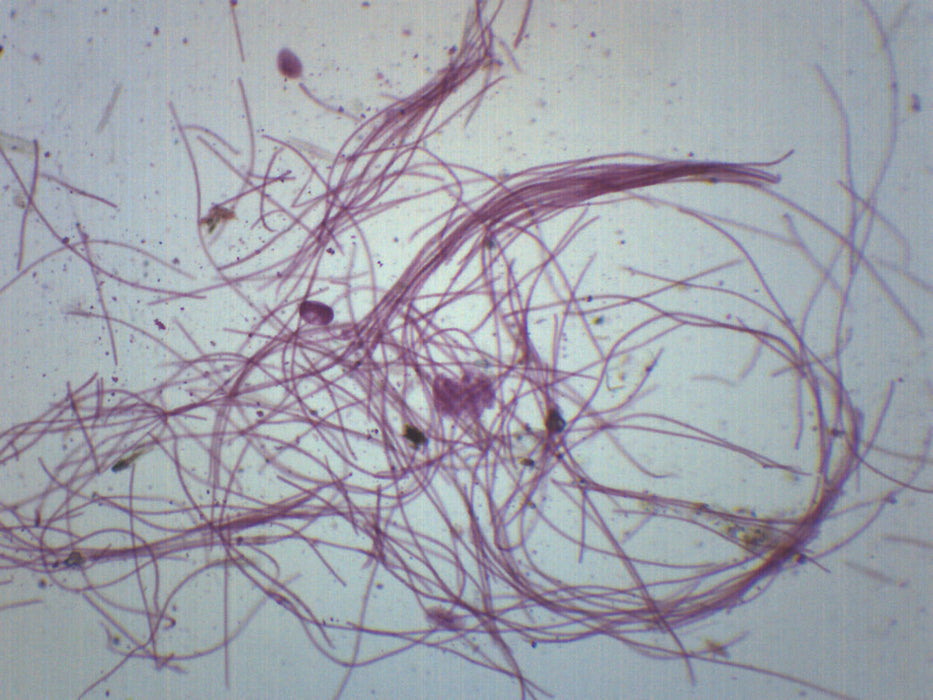Oscillatoria - Prepared Microscope Slide