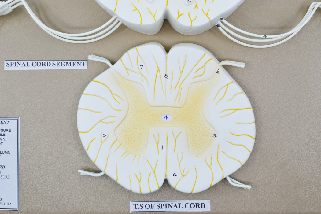 Spinal Cord Model, 17 Inch - Mounted - Includes Nerve Branches