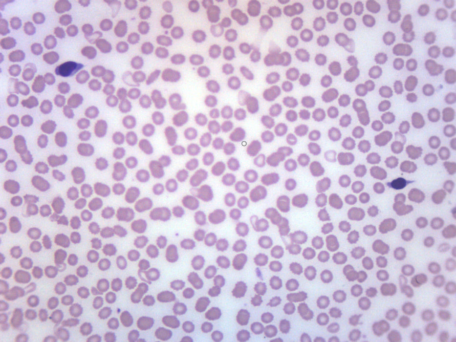 Human Blood Smear WR Stain - Prepared Microscope Slide