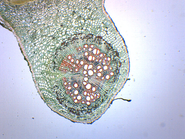 Legume Root Nodule - Prepared Microscope Slide — hBARSCI