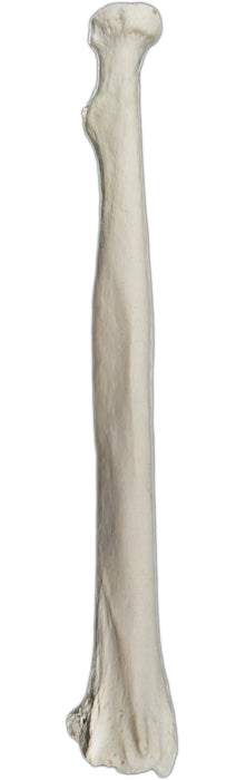 Radius Bone - Right -Anatomically Accurate, Detailed Human Bone Replica