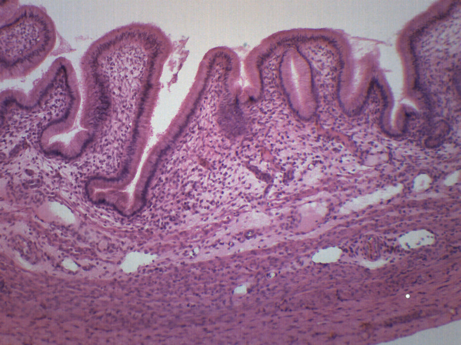 Gallbladder - Prepared Microscope Slide - 75x25mm