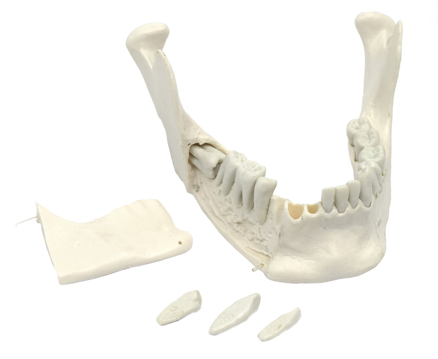 Lower Jaw Bone Model - 16 Extractable Teeth, Removable Jaw Section