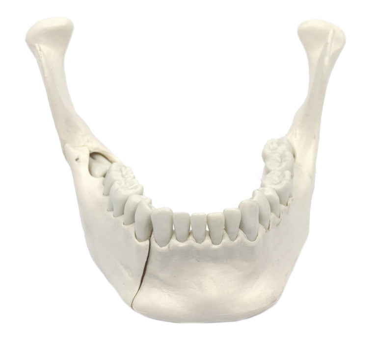 Lower Jaw Bone Model - 16 Extractable Teeth, Removable Jaw Section
