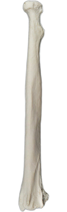 Radius Bone - Left - Anatomically Accurate, Detailed Human Bone Replica