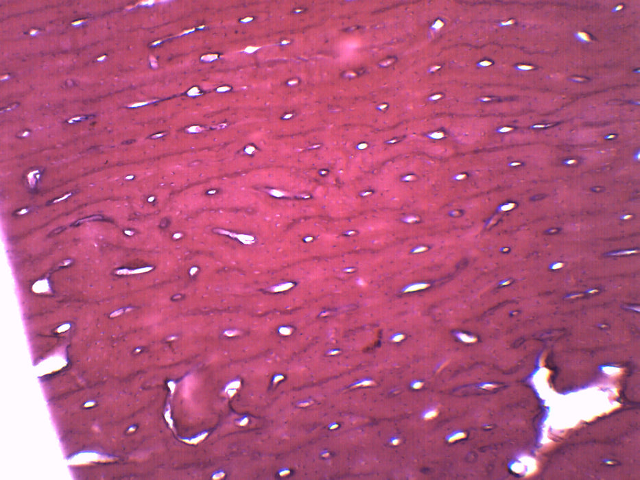 Bone - Cross Section & Longitudinal Section - Prepared Microscope Slide - 75x25mm