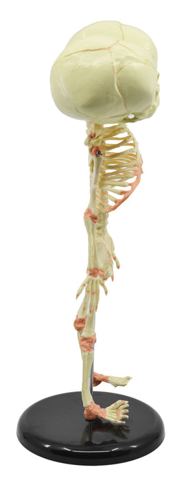 Infant Fetus Skeleton Model, Mini Size - Twin, Conjoined Skull - Rod Mounted