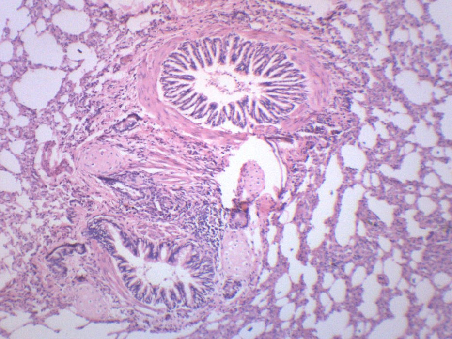 Human Lung Section - Prepared Microscope Slide