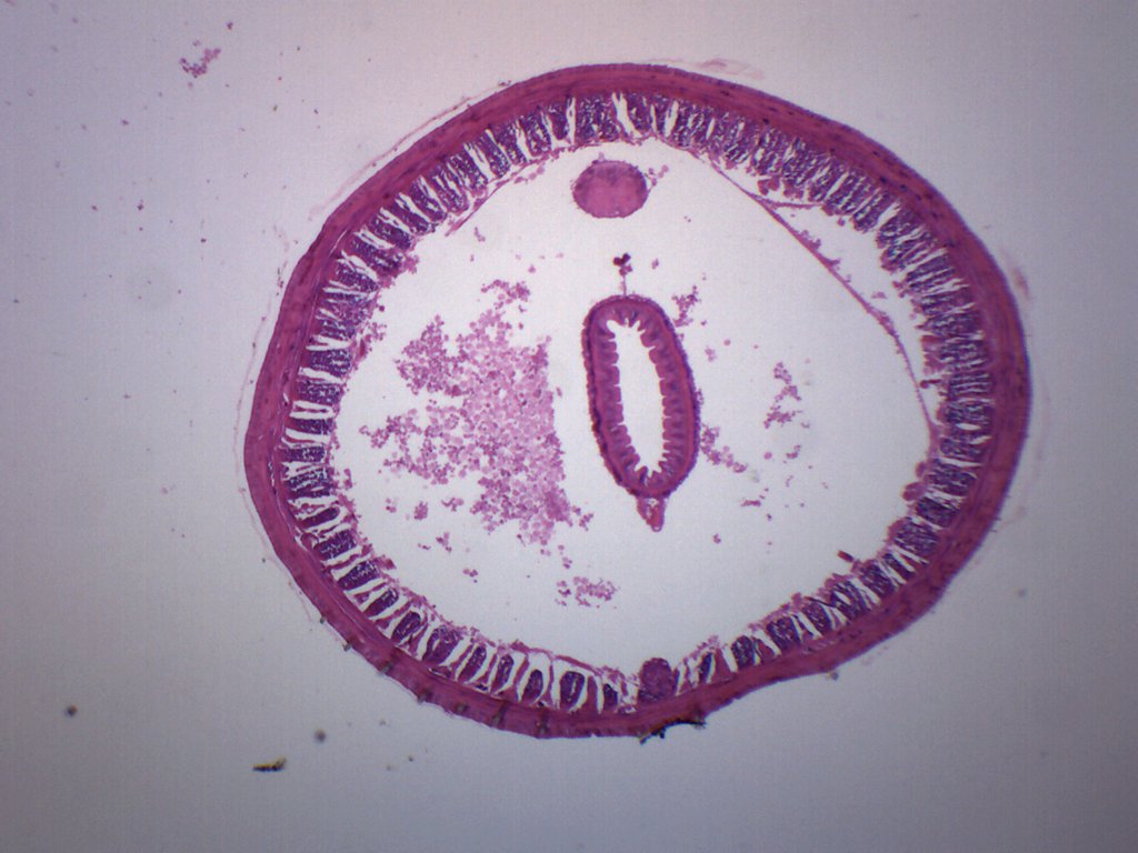 Earthworm Cross Section Labeled